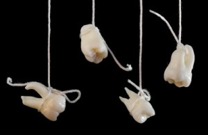 Teeth Falling Out Dreams