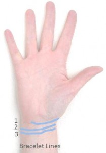 Bracelet Lines on Wrist