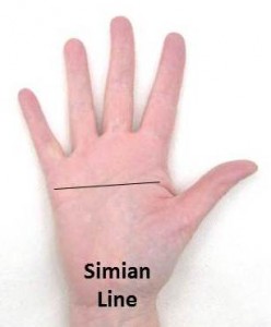 Simian Line